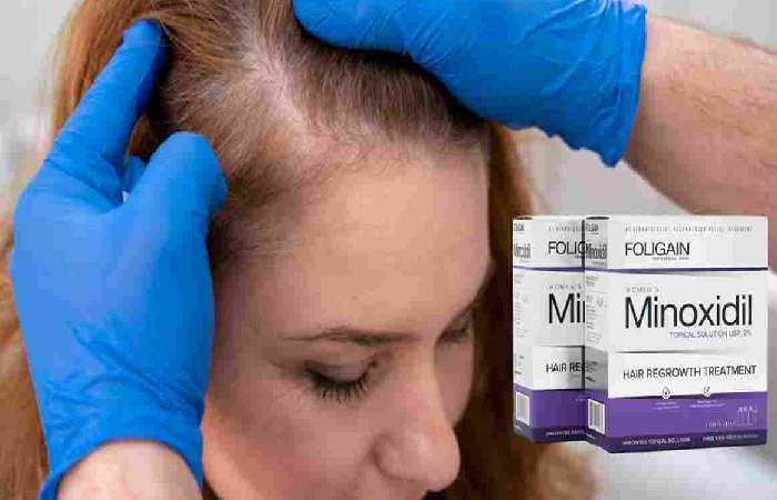 Minoxidil Topical Solution Usp 5 W_V 