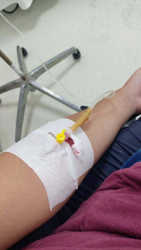 Hospital hand drip pic